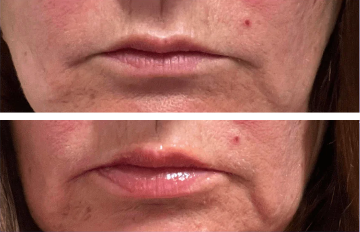 Visible skin improvement results