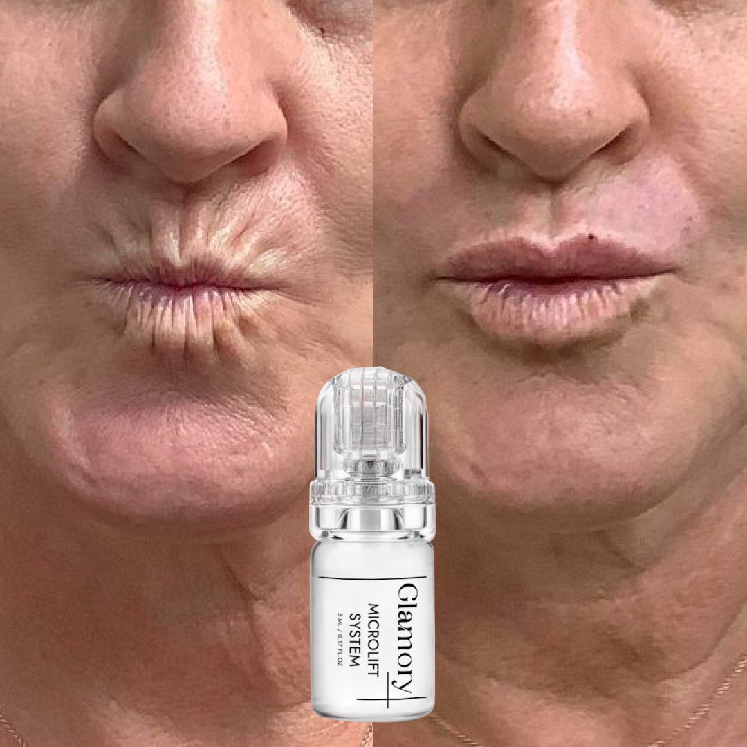 Tighter plumper skin results